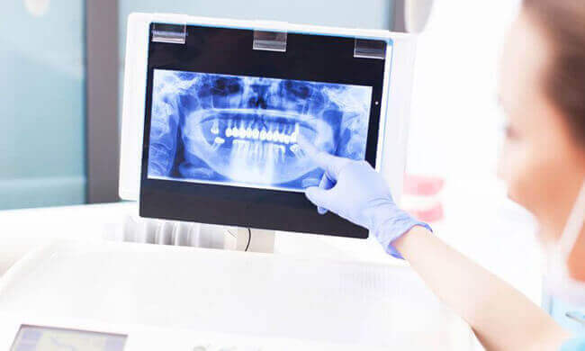 Digital X-Rays