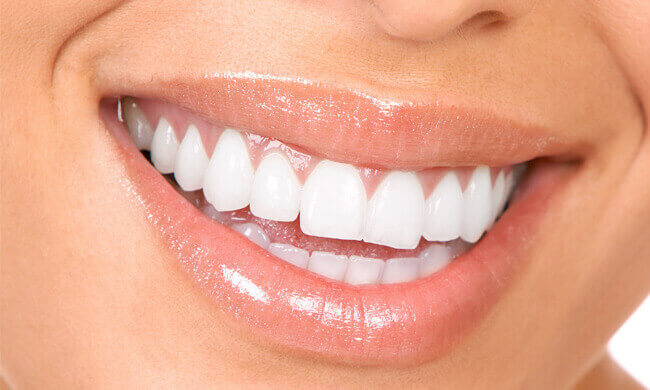 Healthy Gums