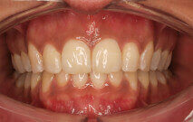 Khadija after treatment