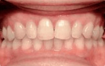 Marie after treatment