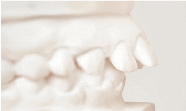 Periodontics / Implants